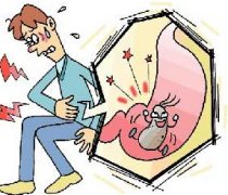 反酸燒心是怎么回事